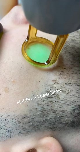 Laser Hair Removal for Men at HairFree LaserClinic