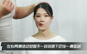 【表情肌测试】快速筛查大小脸，全网最全歪脸自测方法！