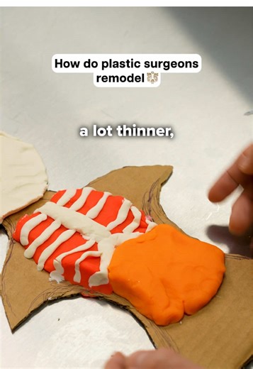 How do surgeons work with ribs? | surgery
