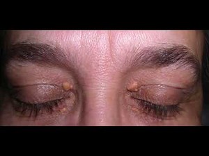 Abdominal Exam OSCE demonstration