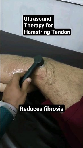 Ultrasound Therapy for Hamstring Tendon Injury #short #shorts #shortvideo #hamstringexercise