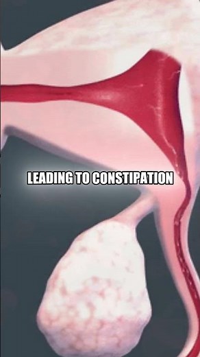 Why women’s hormones affect digestion?