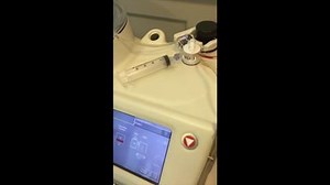 Platelet-Rich Plasma (PRP) Machine in Action