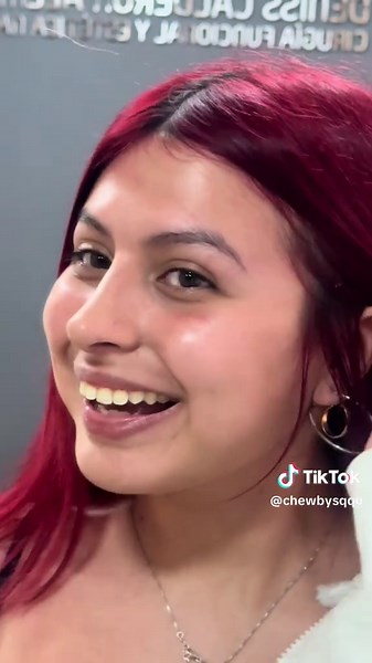 My Rhinoplasty Journey: Reaction to My New Nose