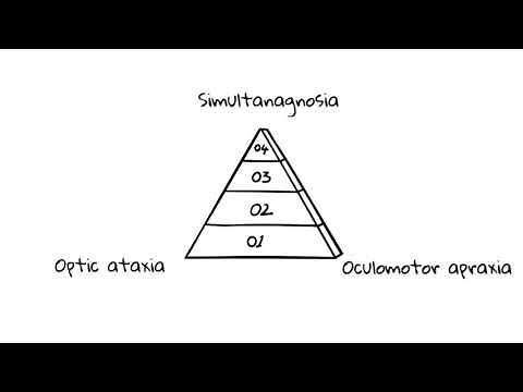 Balint syndrome ( simultanagnosia, optic ataxia, oculomotor apraxia)