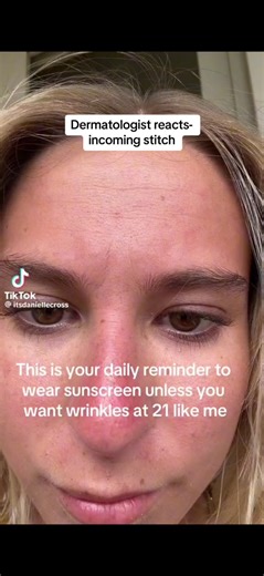 How to Reduce Fine Lines and Wrinkles on Your Forehead