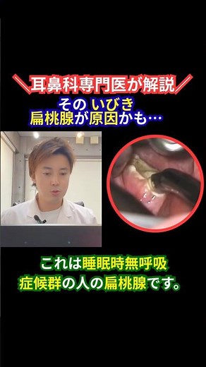 いびき・無呼吸の原因は扁桃腺？睡眠時無呼吸症候群の治療を解説｜名古屋市港区・中川区 #shorts