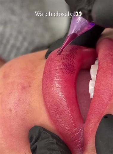 Lip blushing is a semi-permanent cosmetic tattoo that adds color and definition to the lips. It can make lips look fuller, correct dark areas, and save you from wearing lipstick every day. • No, it’s not lip filler — it’s color correction and enhancement. \t•\t Perfect if your lips have lost pigment over time. #lipblushing #lipblushtattoo #permanentmakeup #pmuartist #liptint