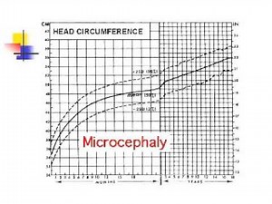 1.4 - Head Circumference - Introduction - Infant Clinical Examination(MRCP)
