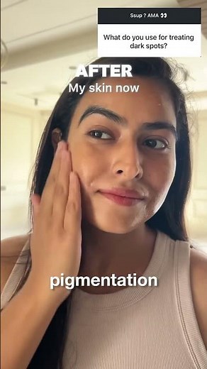 Axis-Y Dark Spot Correcting Glow Serum review !