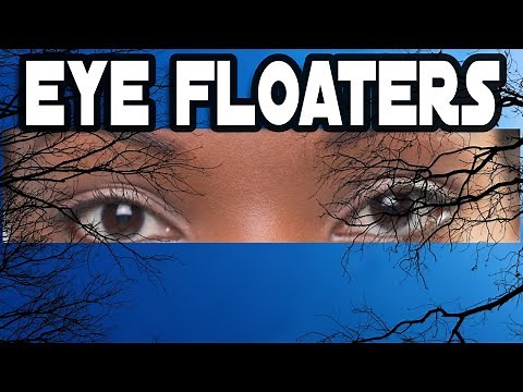 What Are Those Black Lines in My Eyes?!| EYE FLOATERS