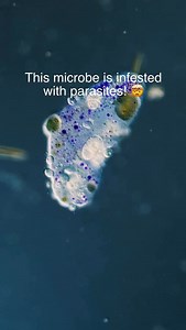 This is a unicellular organism called Nassulopsis, and it is heavily infected with parasites that are slowly feeding on the host and reproducing. All the round structures on and inside the cell are the parasites. . I love Nassulopsis because of the purple pigments in its cell. They swim around in nearby rivers, feeding on filamentous algae and minding their own business until they get parasitized by a group of unicellular organisms called suctorians. . Suctorians have different life stages. A ti