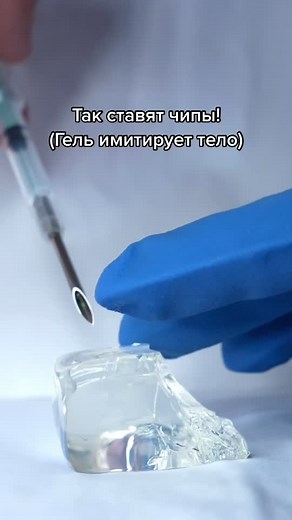 Чипизация человека: установка и функции