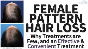 What You Need to Know About Causes of Hair Loss in Women, and Treating Female Pattern Hair Loss