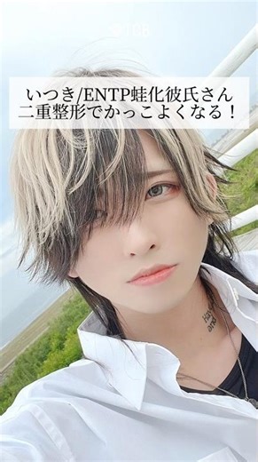 【二重整形】いつき/ENTP蛙化彼氏さん二重整形でかっこよくなる！ #shorts
