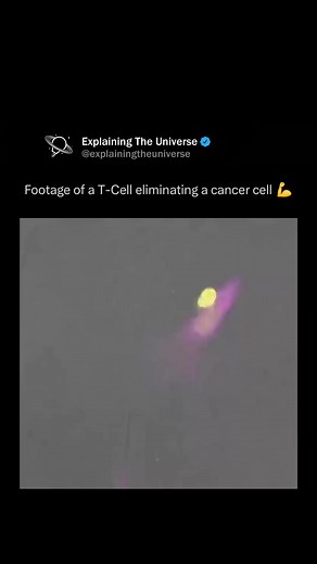 T-cells are a type of white blood cell that play a central role in the immune system’s response to cancer. They can recognize and eliminate cancer cells by detecting abnormal proteins (antigens) on the surface of these cells. Once a T-cell identifies a cancer cell, it becomes activated and releases toxic substances like perforin and granzymes to kill the target. Additionally, some T-cells, such as cytotoxic CD8 T-cells, are especially effective in directly attacking tumors. Cancer immunotherapie