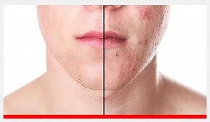 Frequency Separation Retouching in Photoshop  | Adobe Education Exchange