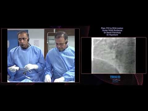 IVUS-Guided RCA Ostial PCI – Imaging-Based Optimization | TRICO 2026