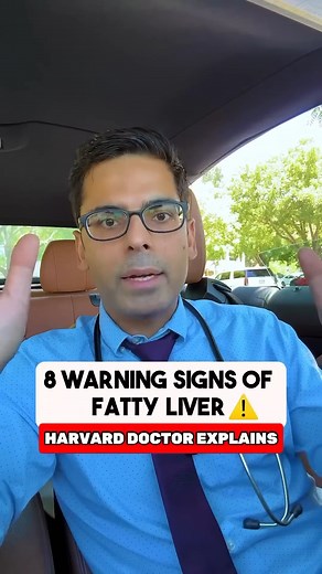353K views · 3K reactions | 8 warning signs your liver might be in trouble ⚠️ Have you noticed any of these signs lately? #fattyliver #liverhealth #drsethi | Saurabh Sethi MD | Facebook