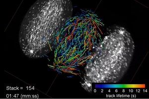 Powerful new microscope sees cell division in real time