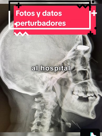 Fotos y datos perturbadores #fotosraras