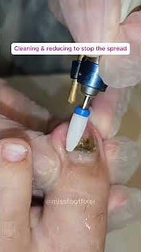 Think your nail looks like this?