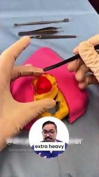 Breast reduction with Breast lift