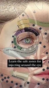 ✨ Elevate your injecting game with the ULTIMATE Botulinum Toxin Injection Guide! ✨ 🔹 Master anatomy with 3D visuals & QR-linked video explanations 🔹 Enhance patient trust with a professional-grade aluminium poster 🔹 Streamline treatments with a built-in unit conversion chart Inject with confidence, precision, and expertise! Ready to uplevel your skills? Comment “SPRING” to order yours now! | Dr Tim Pearce