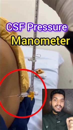 CSF pressure Manometer