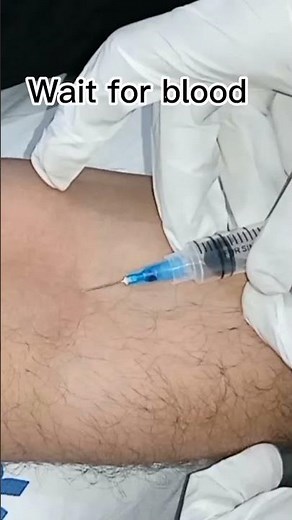 Easy and simple blood sampling from vein