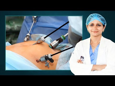 Understanding the Different Types of Hysterectomy