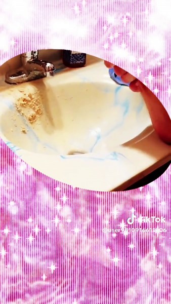 Disgusting pop #pimplepopper #fyp #acne #squeeze #cyst #dermatologist #satisfying