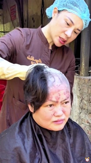 Kepalap gatal dan merah, dengan jerawat kecil dan ketombe terus-menerus. coba sampo selenium disulfida ini!#antiketomebe#scalppimples #oilyhair#antidandruff