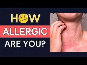 How To Test For Food Allergy SAFELY | Dr. David Fitzhugh