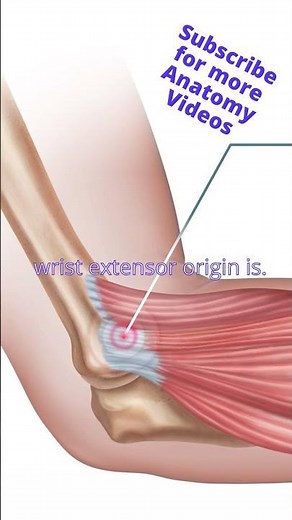 Is it golfer's or tennis elbow?