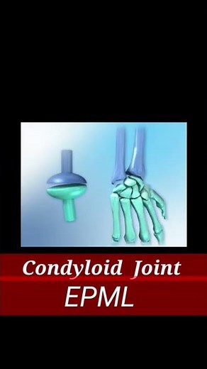 Condyloid Joint anatomy 💥EPML