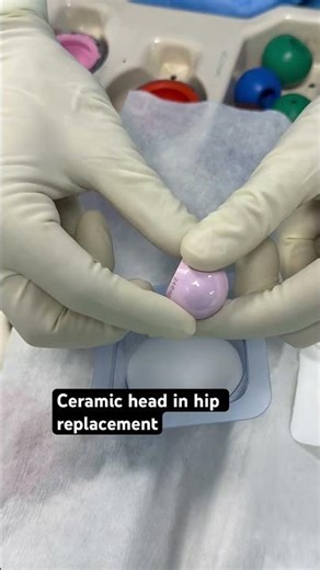 CERAMIC HEAD CLOSE UP #hipreplacement #physiotherapy #bonehealth
