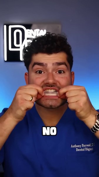 Crest 3D White toothpaste review + Guru Nanda - total smile makeover kit (7 day review)