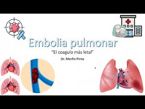 Embolia pulmonar (EP) - "El coágulo más letal"