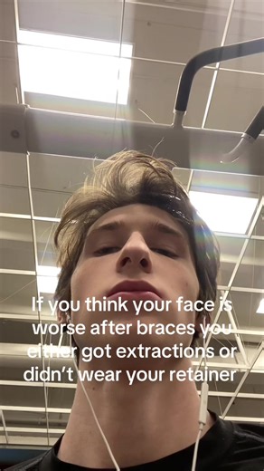 #orthodontics #braces #damonbraces | retainer