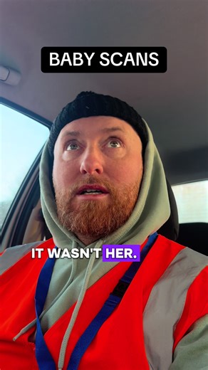 Understanding Baby Scans: What to Expect During Pregnancy