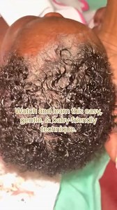 How to remove cradle cap safely and minimize hair fall This allows you to remove it without vigorously combing/scraping it out of the scalp. You also have the luxury if using 100% vegan, homemade product with clean and safe ingredients made with babies in mind follow @lachelbeaute for more tips! #lachelbeaute #CradleCapCare #BabyScalpSolutions #GentleBabyCare #NaturalRemedies #HealthyBabySkin #CradleCapRelief #BabySkincare #ScalpCareForInfants #SoothingBabyScalp #CradleCapNoMore | LachelBeaute