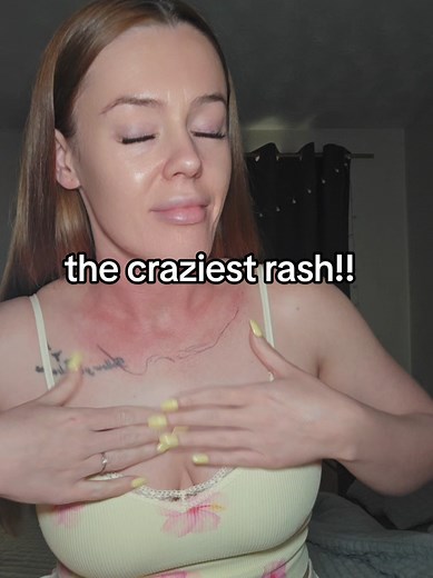 Sore, Itchy Rash: What Could It Be?