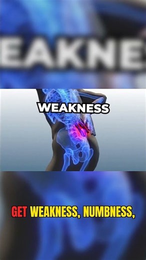Do you have Spinal Stenosis? Check these symptoms! #spinal stenosis