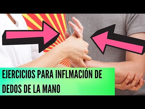 Exercises to reduce finger swelling/how to reduce finger swelling