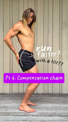 37K views · 178 reactions | Anterior tilt and flat feet: dysfunction...