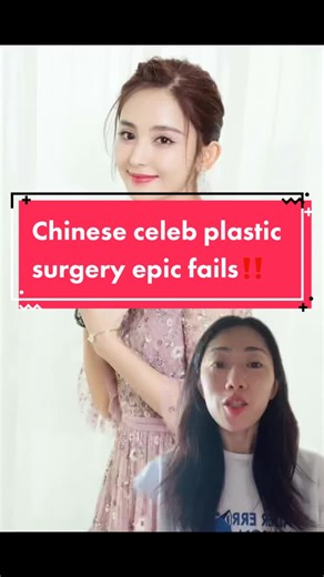 Bigger is not always better when it comes to double eyelids on a Chinese face #beauty #beautyhacks #beautytips #plasticsurgery #chinese
