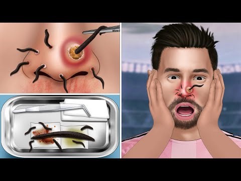 [ASMR] Help Messi get rid of leeches on his nose | WOW Brain Satisfying Video