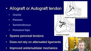 Lateral Ankle Ligament Repair Techniques: Lateral Repair With Augmentation
