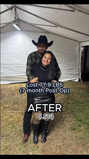 77 Lbs Lost in 7 Months! 😱 Incredible Gastric Sleeve Transformation with Dr. Khan